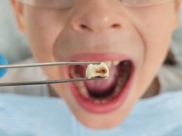 Best After-Hours Dental Trauma Care in Forrest City, AR